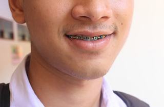 close up of young man with braces