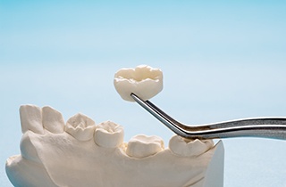 Tweezers holding dental crown over cast model of teeth