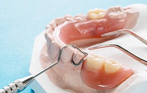 partial dentures on a wax model of teeth