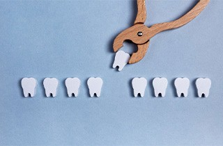 Illustration of tooth being extracted from a dental line up