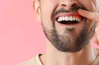 a close-up of a man with swollen gums