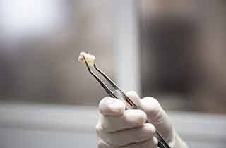 Dentist holding an extracted tooth