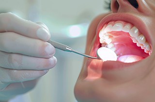 Wisdom tooth removal is easy in Dallas, TX