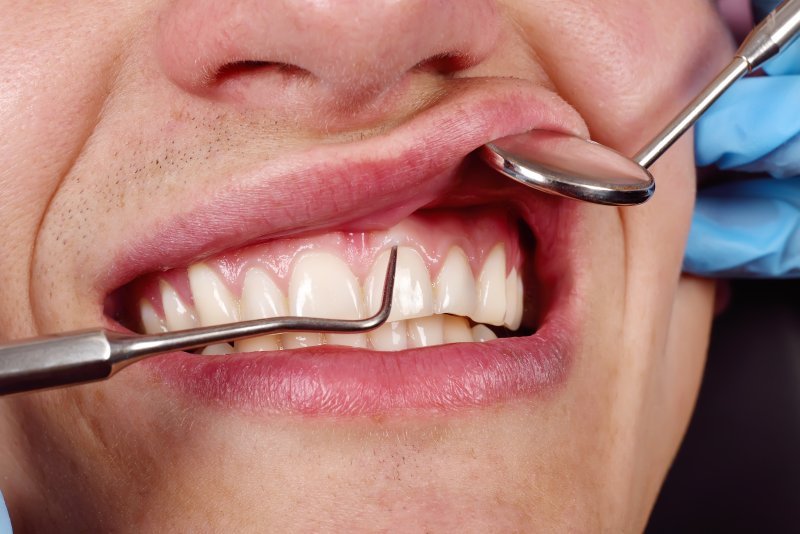 patient getting a dental checkup in Mesquite