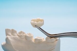 new dental crown next to a mold of teeth